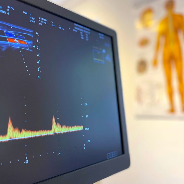 ULTRASCHALL HIRN-/HALSGEFÄßE